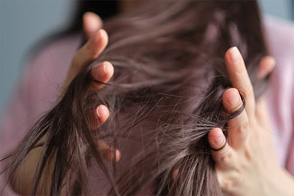 Hormonal Hair Loss in Men and Women: Why Treatments Like Dutabiot Might Be the Answer